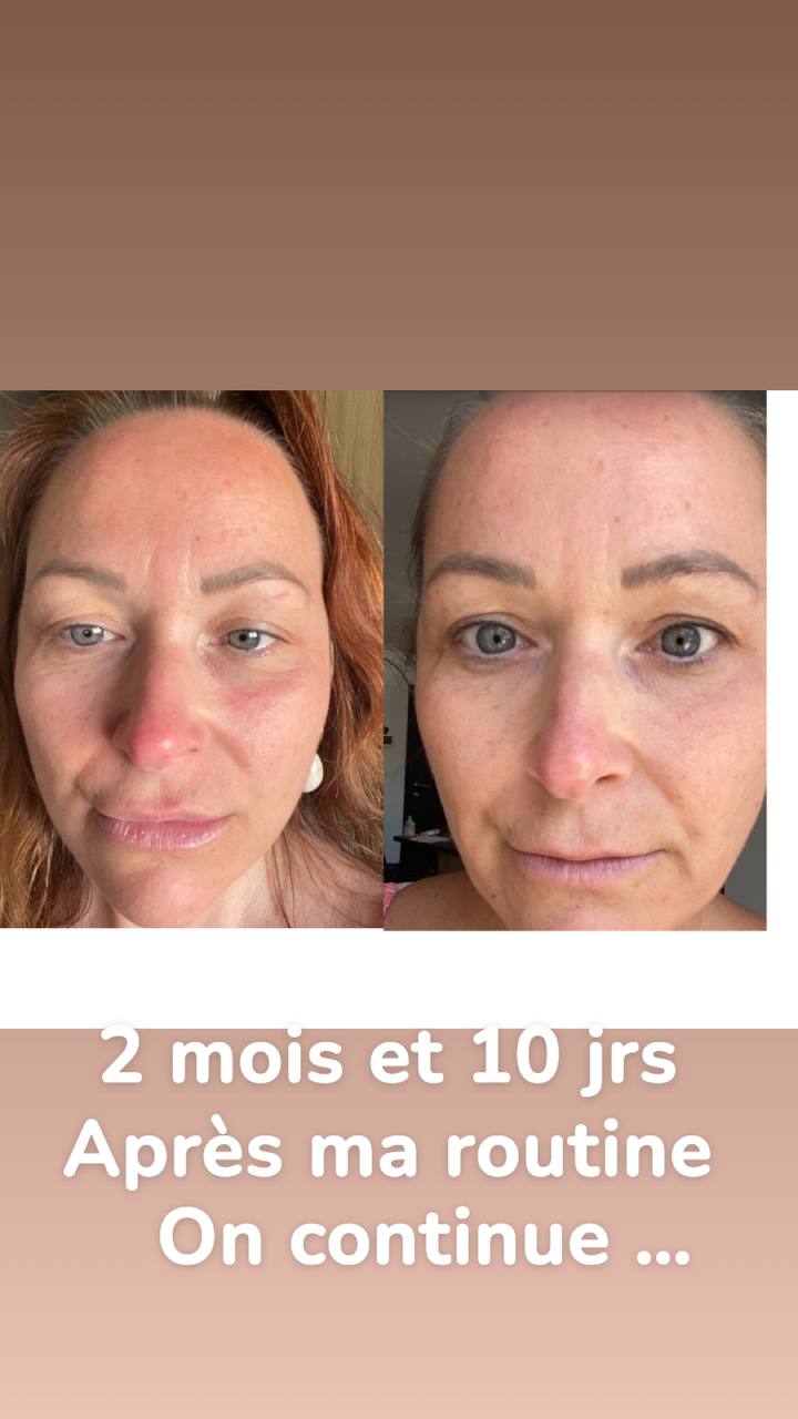 Crème de jour anti-rides effet « time freeze » avec ALPHADERM™